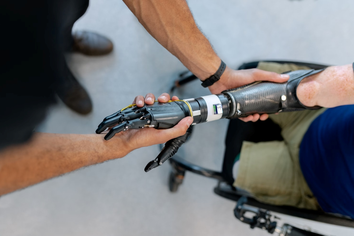 Prosthetic arm that could be controlled via neuronal organoid in the future