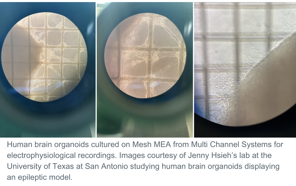 3 Organoids Sara M Jenny H UTSA lab with caption