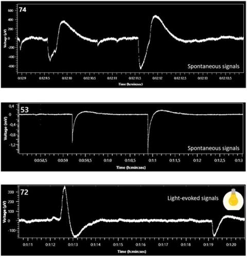 Electrical signals measured by Mesh MEA - Multi Channel Systems - Organoid Electrophysiology